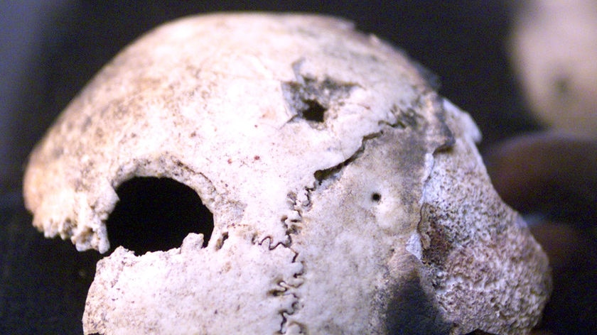 A fragment of bone that experts claimed was Adolf Hitler's skull