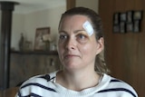 Amanda Treagus sitting in a chair with a bandage on the right side of her forehead