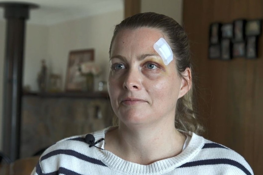 Amanda Treagus sitting in a chair with a bandage on the right side of her forehead