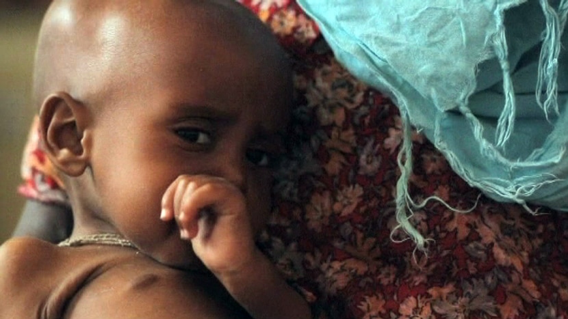 Kenyan child clings to life