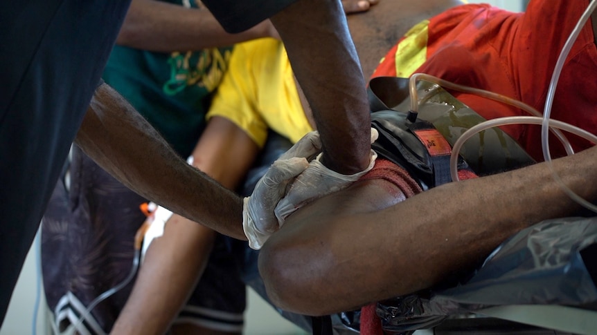 A close-up shows a man pushing two gloved hands onto another man's thigh, with tubes and bandages sticking out