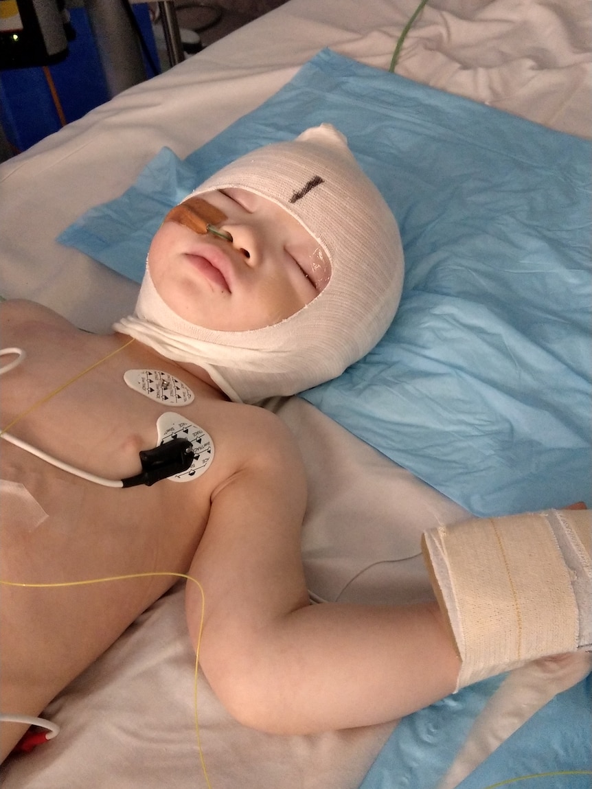 A toddler recovers on a hospital bed, her head wrapped in bandages