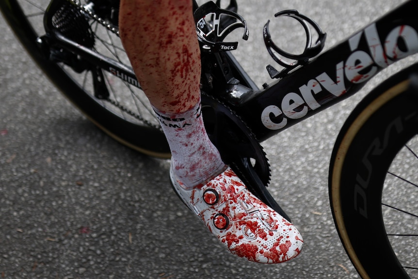 Blood is seen on the leg and shoe of a cyclist