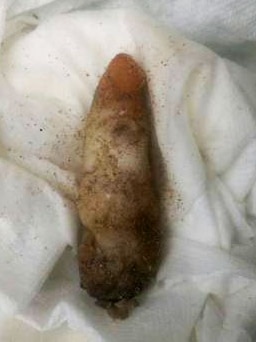 A mysterious object which looks like a human finger found on a Darwin beach