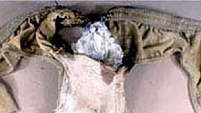 The slightly charred and singed underpants with the bomb packet still in place