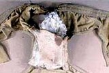 The suspect had 80 grams of PETN sewn into his underpants.