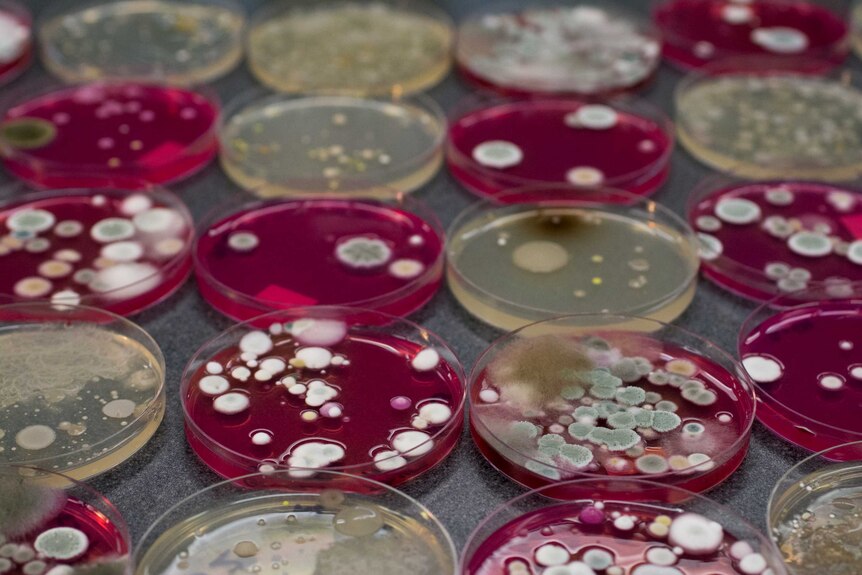 Petri dishes containing bacteria, in clear and purple liquid.