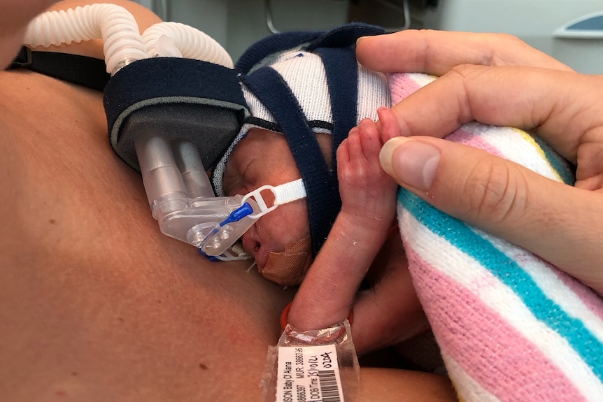 Mother Alana Wilkinson's hand holds premature baby Rafferty Robb 