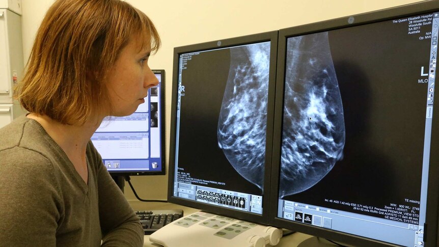 Should women know about their breast density? It's an issue