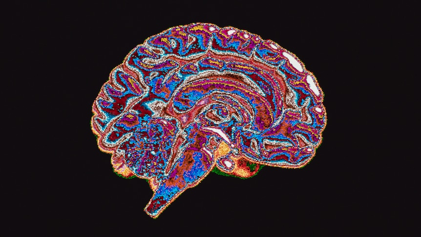 Colourful illustration showing a cross-section of human brain.