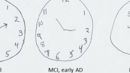 The clock-drawing task.