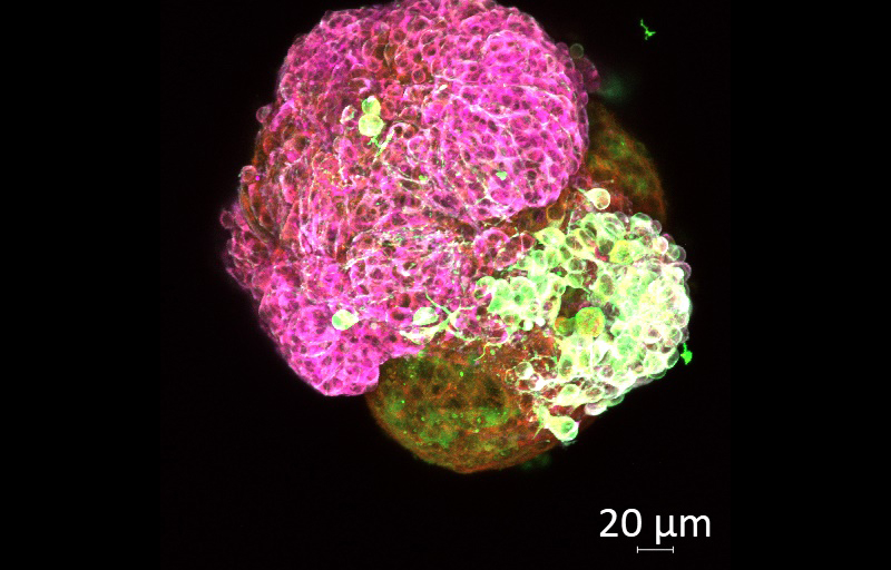 A blob of cells, seen under a microscope, coloured pink and green