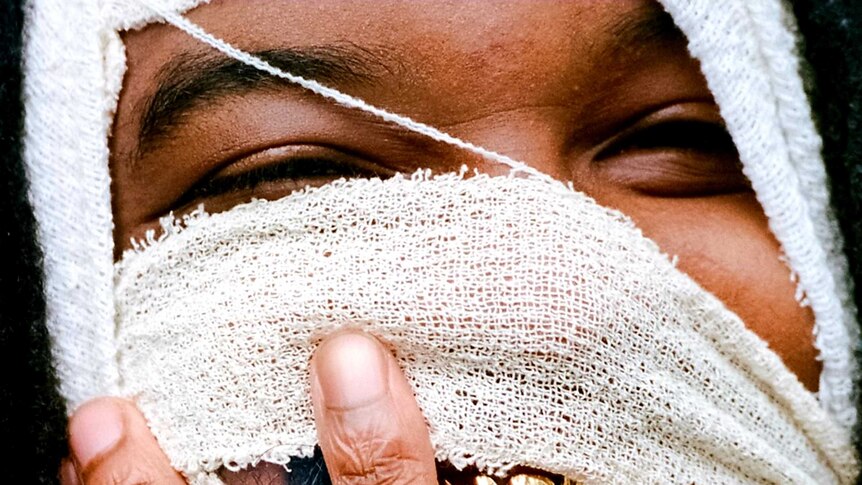 Photograph of Genesis Owusu with gold-plated teeth and a white bandage over his face.