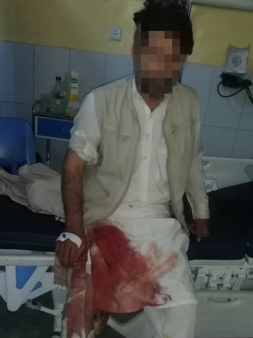 A man sitting on a hospital bed with part of his clothes covered in blood - his face blurred 