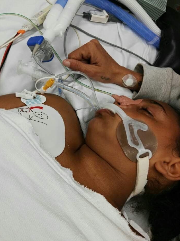 A girl lies on a hospital bed with tubes coming out of her mouth.