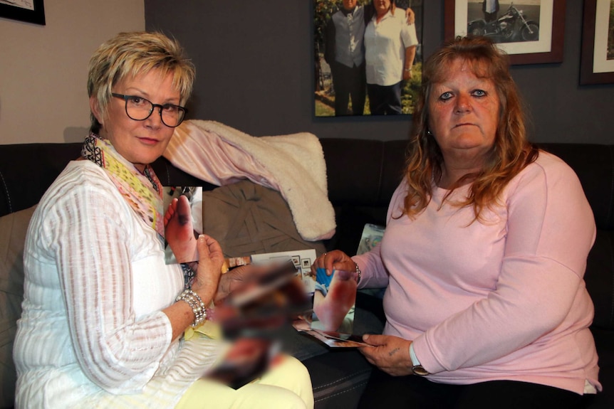 Relatives hold photo of Gail Reynolds' gangrenous foot