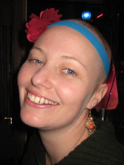 A woman with a bald head smiles at the camera