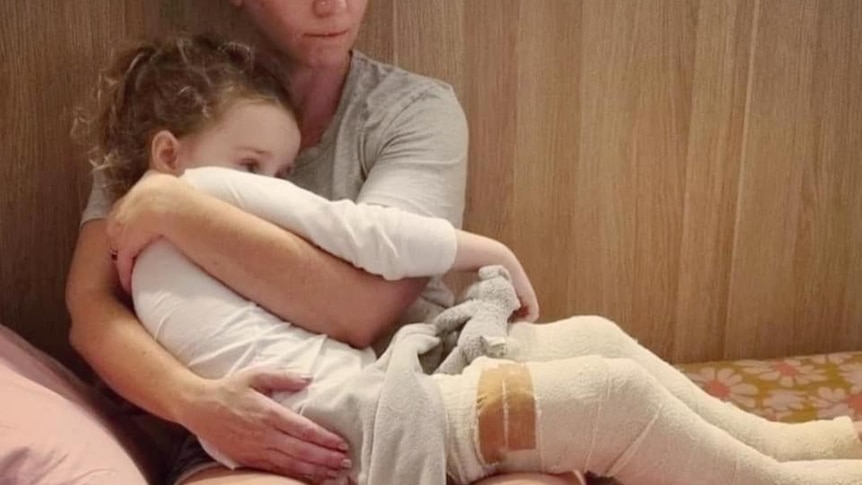 A women cuddles her daughter who has casts on both of her legs. 