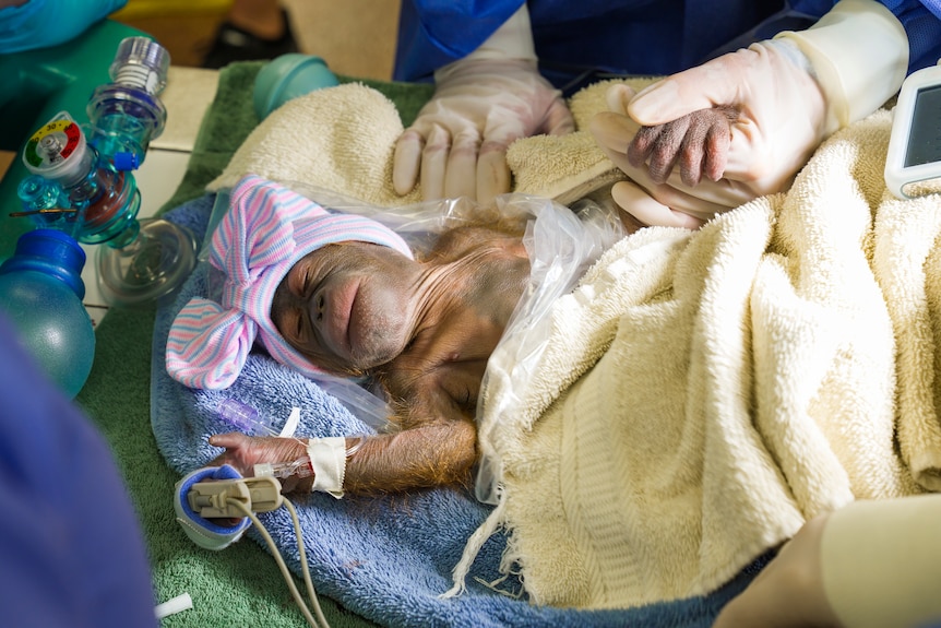 Image of a baby orangutan, she is laying on towels with medical equipment around her as a gloved person holds the baby's hand