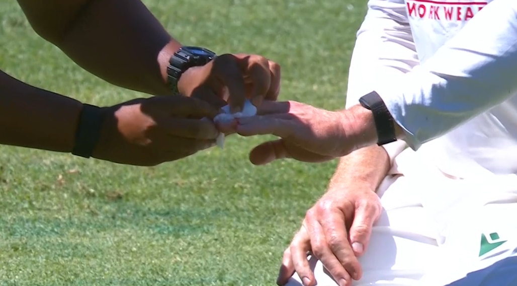 A close up shot of a cricketer receiving treatment on a bloody nail from another man's hand