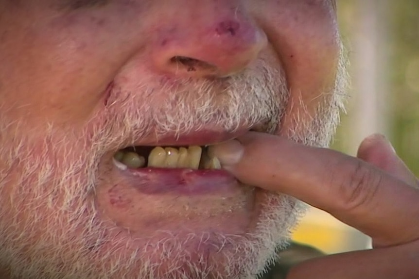 A close up of a man pointing to his teeth