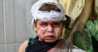 A child with a bloodied face looks at the camera with a bandage wrapped about their head.