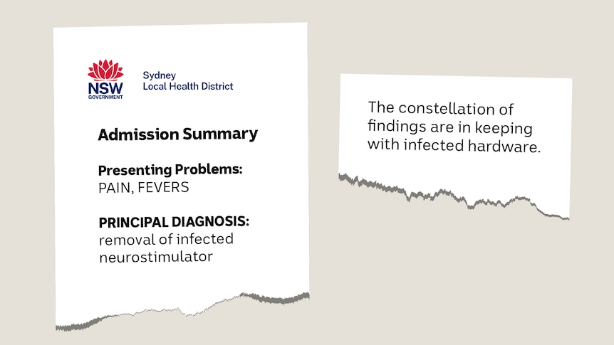 A graphic showing excerpts of a medical record with diagnosis of "removal of infected neurostimulator".