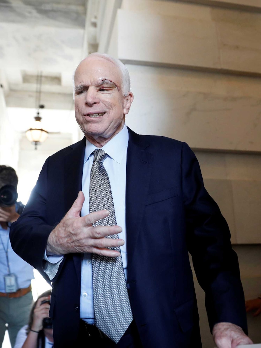 Senator John McCain leaves the Senate in a suit with a notable scar above his left eye