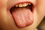 A child pokes out their tongue