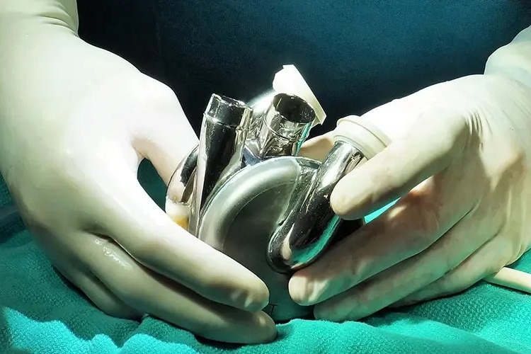A close up of gloved hands holding an artificial heart made of metal and plastic.
