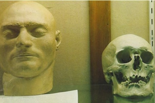 The skull believed to be Ned Kelly's before it was removed in 1978