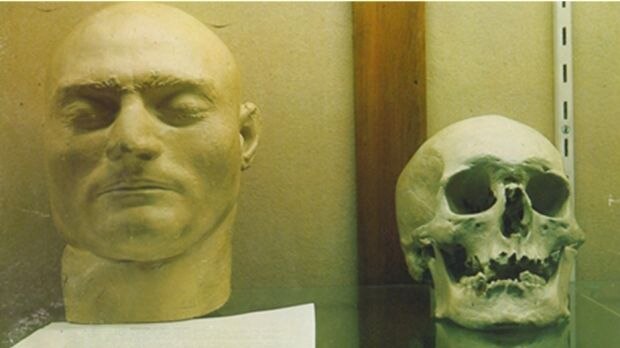 The skull believed to be Ned Kelly's before it was removed in 1978