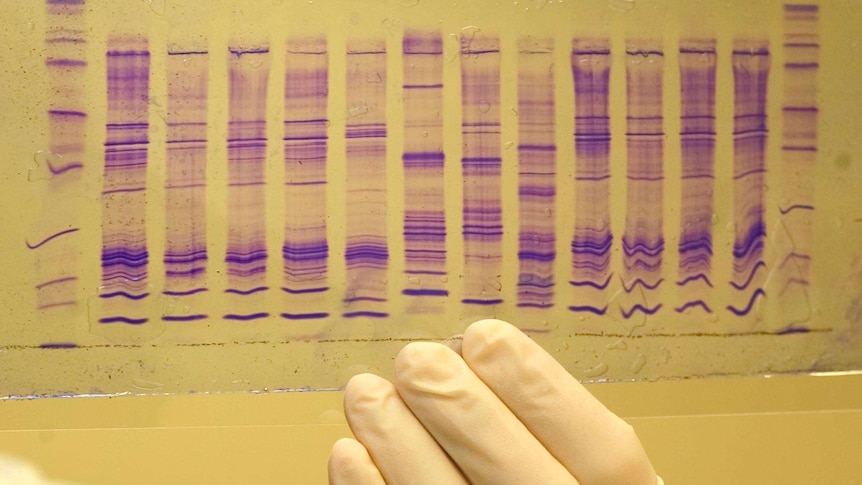 A chemist reads a DNA profile.