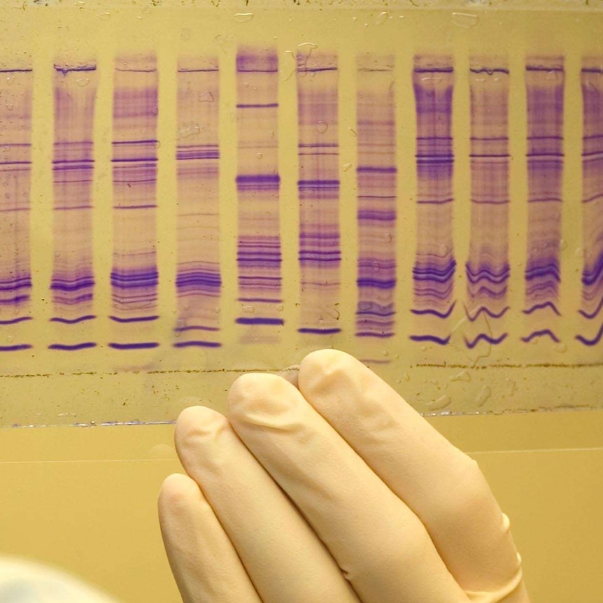 A chemist reads a DNA profile.