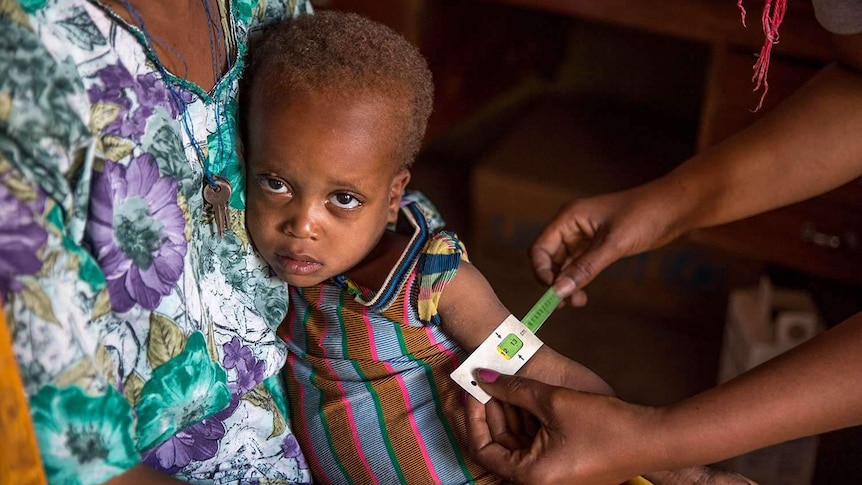 A boy receiving medical treatment for malnutrition in Ethiopia