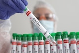 a scientist hold up a test tube that says 'bird flu' on it