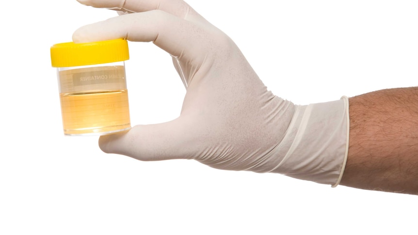 Hand wearing a rubber glove to hold a urine sample