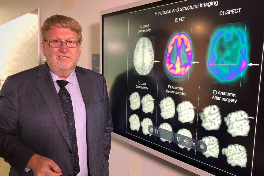 Prof Graeme Jackson standing next to a display showing scans of a brain