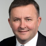 Anthony Albanese