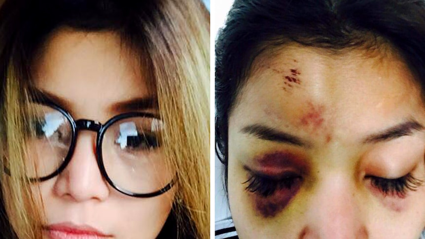 Ek Socheata posts Facebook photos of injuries
