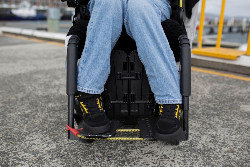 A close-up of Janelle McMillan's legs. Ausnew Home Care, NDIS registered provider, My Aged Care