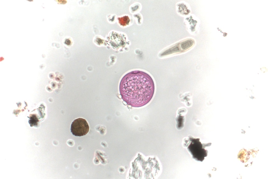 Microscopic image of a grass pollen grain.