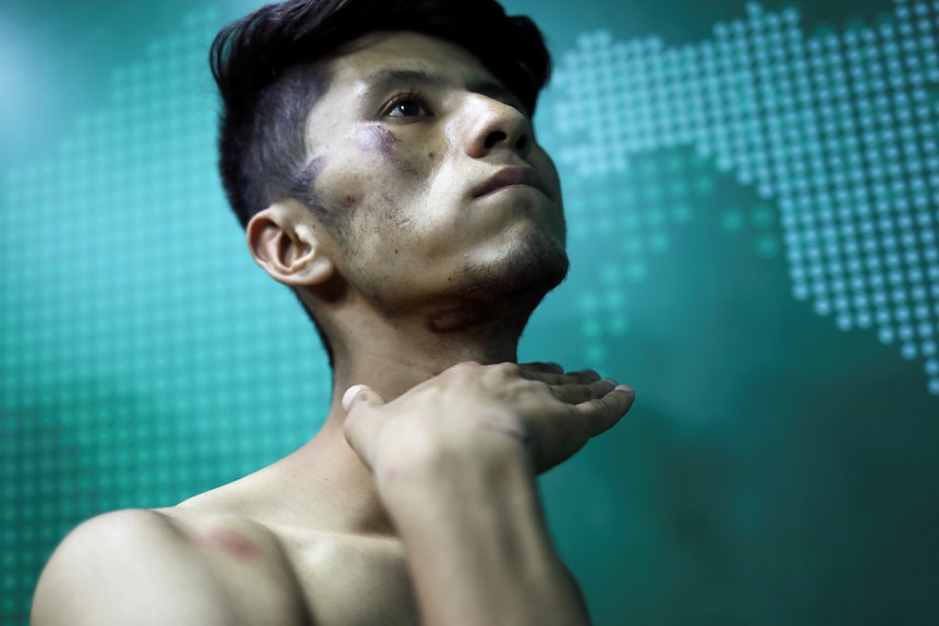 A man shows bruises on his face and neck