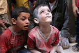 Syrian children injured in Russian airstrikes
