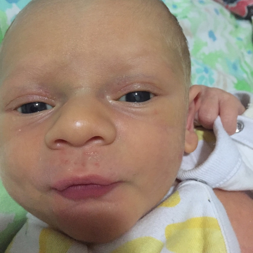 A baby looks at the camera. There is a bit of cloud over his left pupil.