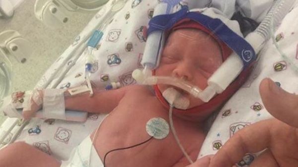Baby Eleanor Petrak, who was born four weeks premature, in a hospital crib.