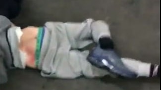 A boy lies on the ground with his broken ankle flopping behind him.