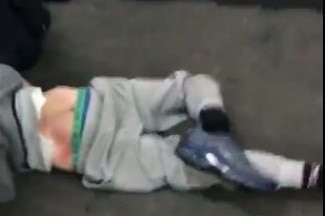 A boy lies on the ground with his broken ankle flopping behind him.