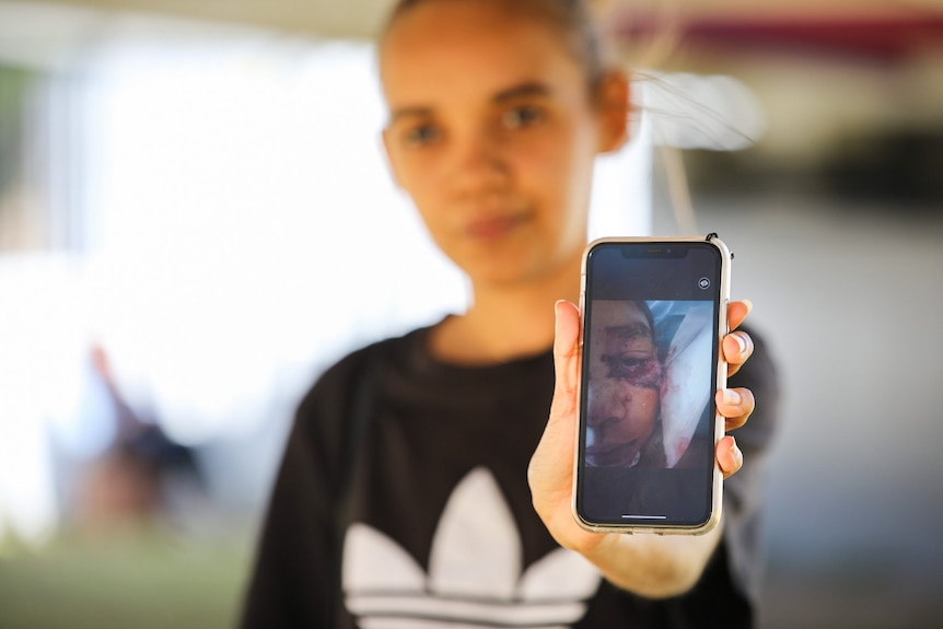 A woman holds up a phone showing a picture of a teenage boy with injuries to his face.