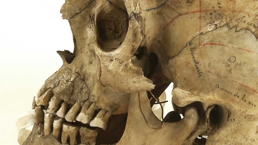 Human skull inscribed for phrenological demonstration